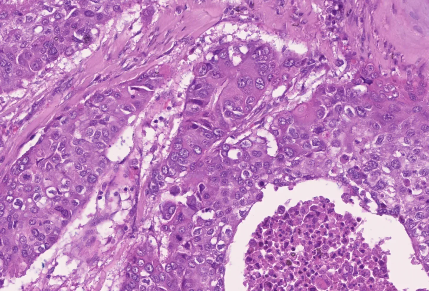 Microscope image of an H&E-stained tissue section